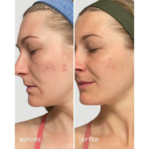 Nourish MCT Cleansing Oil - Cleanser - Three Ships Beauty